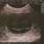 Puppy sonogram 4 weeks gestation, 7/5/09